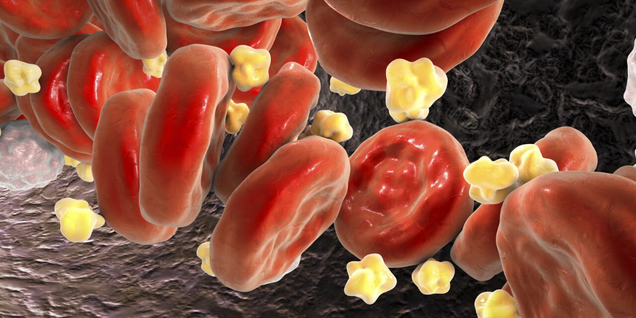 Folic Acid and Cholesterol: A Surprising Connection