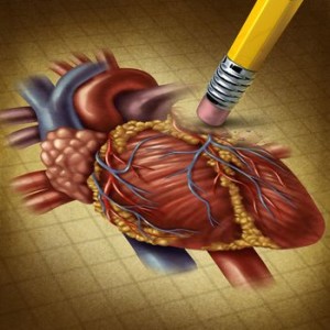 Losing Human Heart Health
