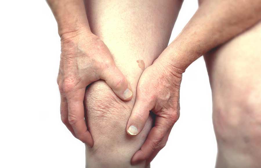 Arthritis in the Knee? Think Twice Before Surgery