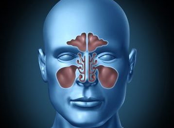 Is Your Sinusitis From a Fungus? No Wonder Antibiotics Don’t Help