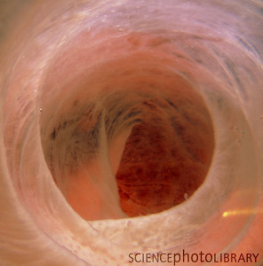Endoscopic image of human small intestine