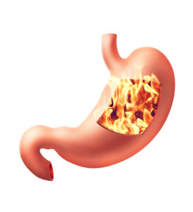 Photorealistic 3d illustration of human stomach with heartburn disease