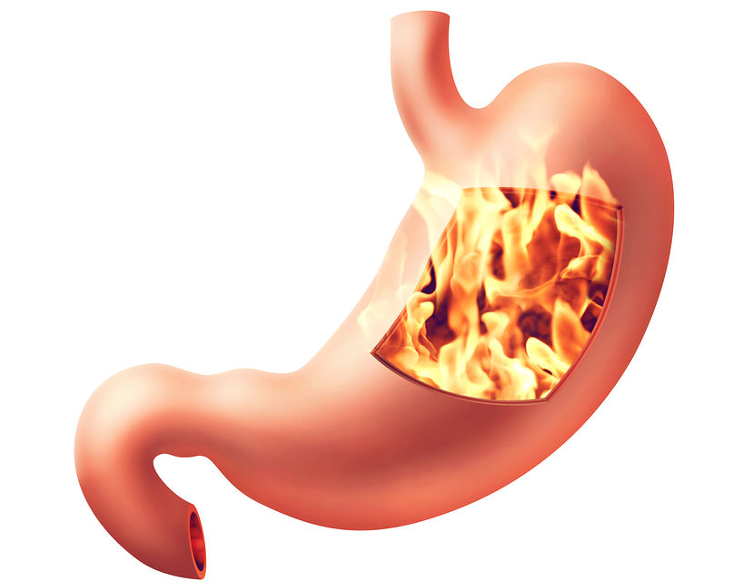 A Few Words About Gastric Reflux