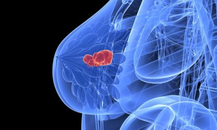 Lowering Breast Cancer Risk