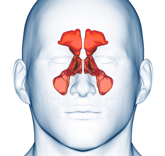 Catching a lot of Colds? Maybe it is Your Sinuses