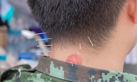 PTSD and Acupuncture
