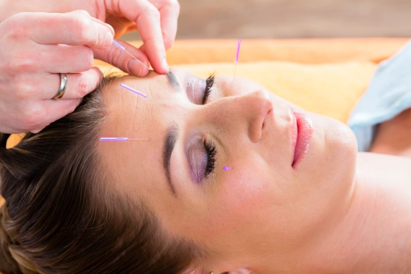 Chronic Headaches and Acupuncture