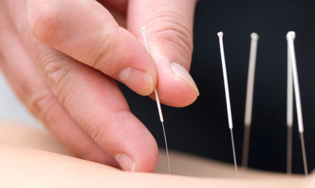 Acupuncture and Exercise Performance