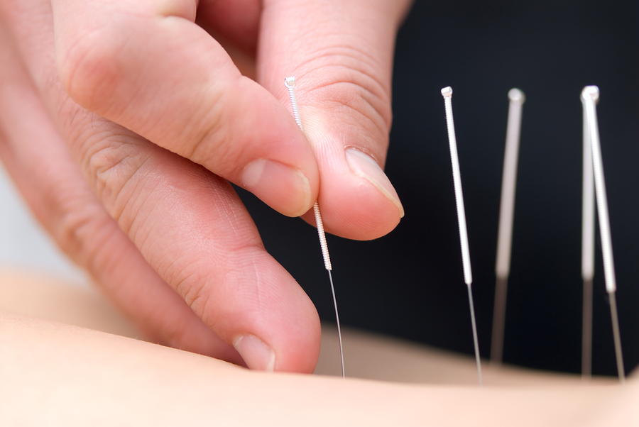 Depression and Acupuncture Whole Health 