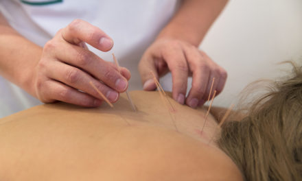 Fibromyalgia and Acupuncture
