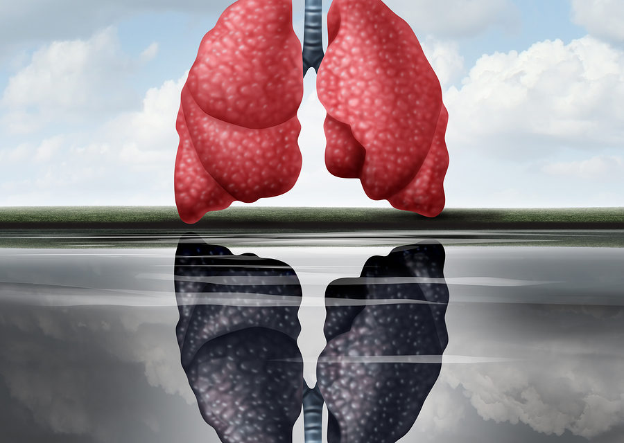 Nutrition and Lung Disease
