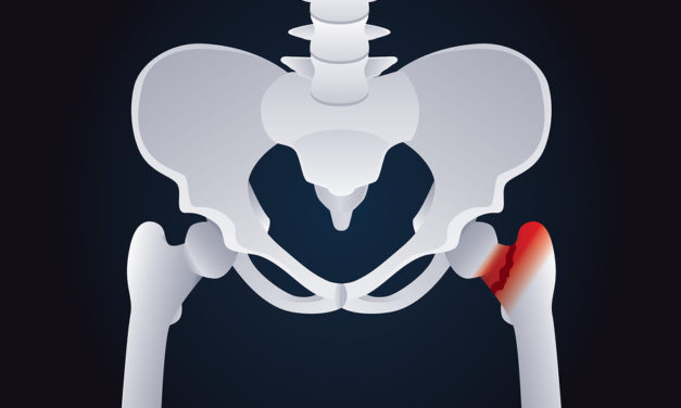 Are Antacids Linked to Hip Fracture?