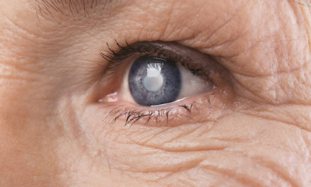Nutrients Reduce the Risk of Cataracts