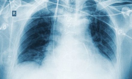 Zinc may Help Prevent Pneumonia
