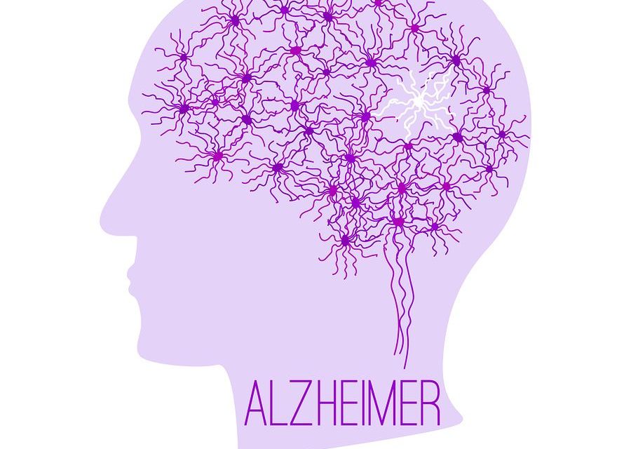 Can Supplements Help Prevent Alzheimer’s Disease?