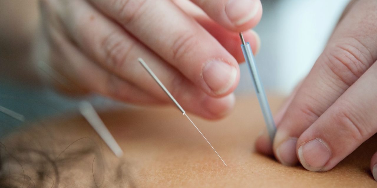 High Blood Pressure and Acupuncture
