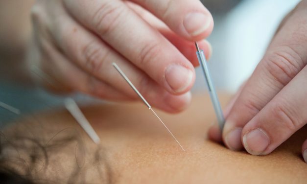 High Blood Pressure and Acupuncture